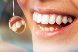 Minimally Invasive Periodontal Gum Therapy