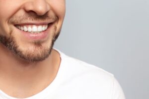 Reasons for teeth whitening