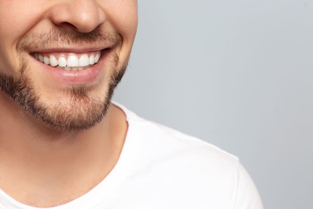 Tooth Whitening